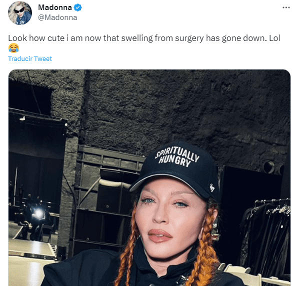 Madonna dejó constancia de que todo fue culpa de la cirugía. Foto Twitter